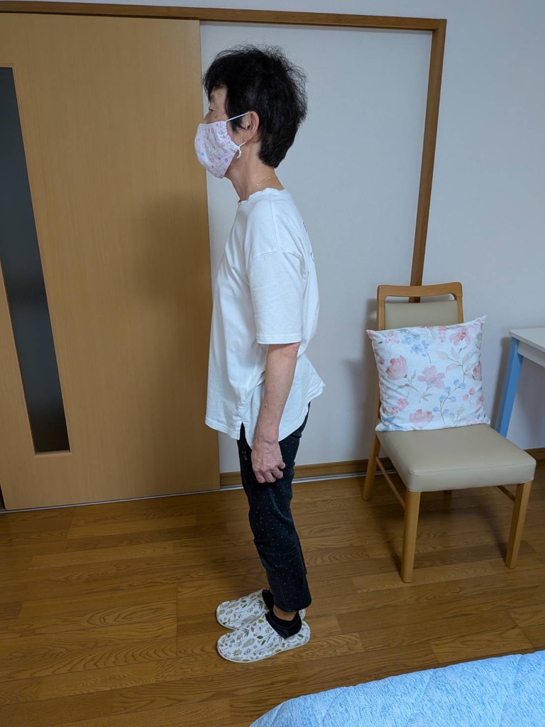 Aさん アフター