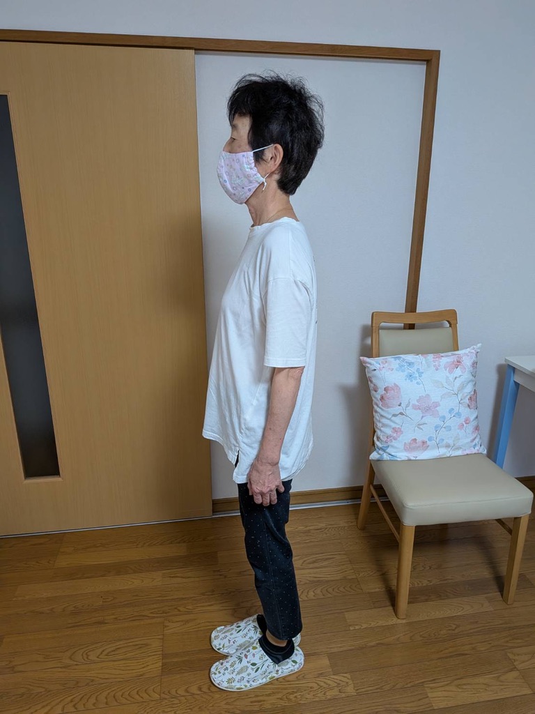 Aさん ビフォー