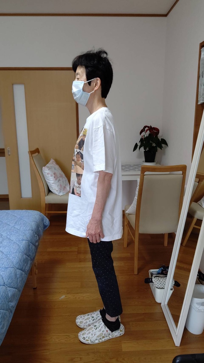Eさん ビフォー