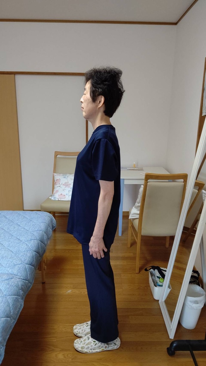 Dさん アフター